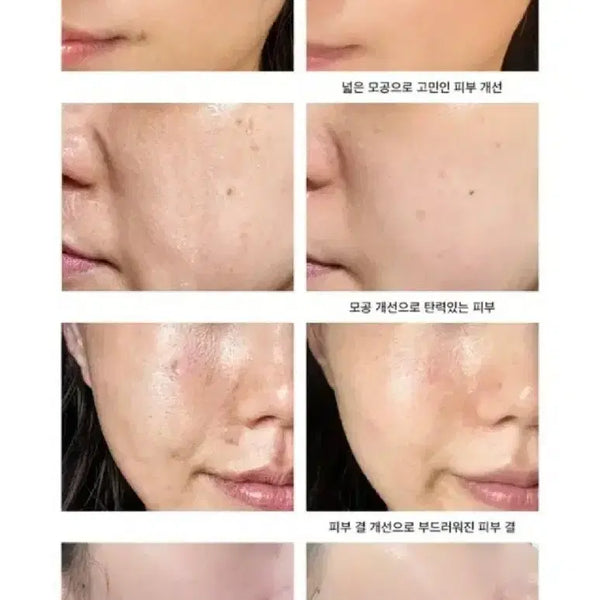 [BUNJANG] Antoinette Cell Honey Skin Cream / 대용량 수분 물광 모공 탄력 8종 국민화잘먹크림 앙투아네셀 허니스킨 크림