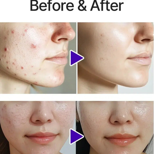 [BUNJANG] Rejena Deep Aqua Gel / 홍조 열감 피지억제 수분감 피부장벽을 지켜주는 레제나 딥 아쿠아 젤