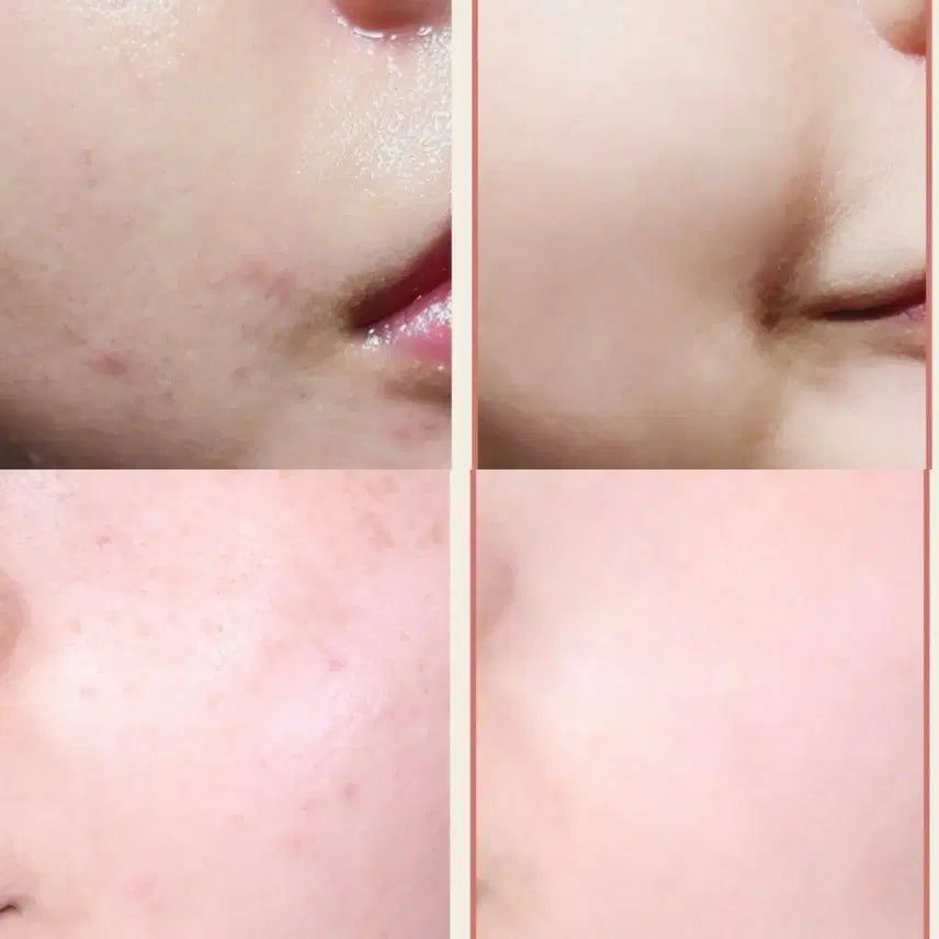 [BUNJANG] Laboreve Peach Microbiome 84 EGF Serum 30ml / 840억유산균 라보레브 피치마이크로바이옴84 EGF세럼
