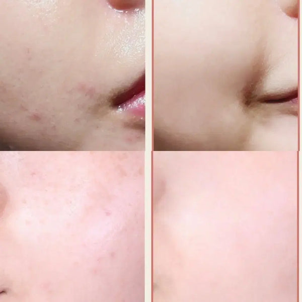 [BUNJANG] Laboreve Peach Microbiome 84 EGF Serum 30ml / 840억유산균 라보레브 피치마이크로바이옴84 EGF세럼