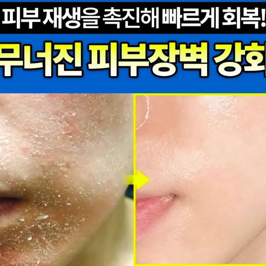 [BUNJANG] Soft Return Sea Tangle Cream (50ml) / 좁쌀여드름 뾰루지 속건조 청소년 여드름 장벽재생 소프트리턴감태크림