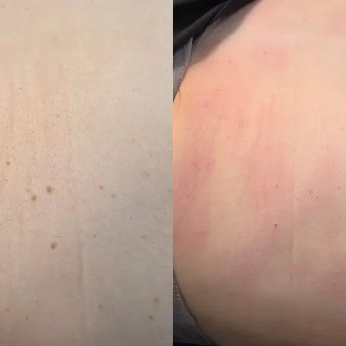 [BUNJANG] Young & Beauty Clinic: Effective Skin Management Solutions / 바로바로 효과 보세요~