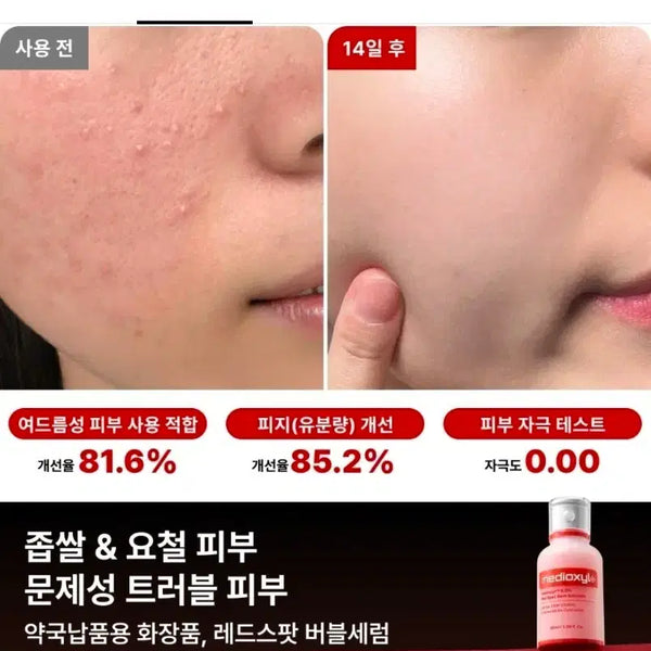 [BUNJANG] Medioxil Red Spot 50ml / 메디옥실 레드스팟 50미리